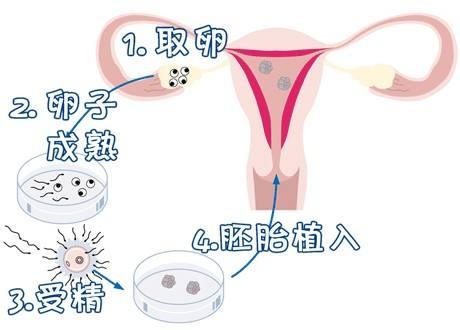 孕妈供卵代怀助孕咨询微信群